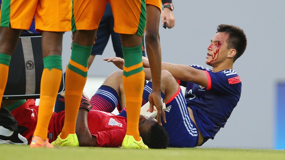 شينجي اوكازاكي|مصدومیت اوکازاکی در دیدار مقابل زامبیا.