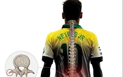 محل دقیق مصدومیت نیمار + عکس