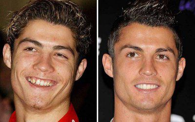 Top Ten | ده ورزشکار برتر که با روزهای اولیه ی خود قابل مقایسه نیستند