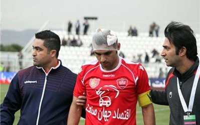 نوروزی: دروازه‌بان گسترش فولاد مانند کشتی‌کج کاران من را زد / اميدوارم در دربی‌ بازی‌ كنم