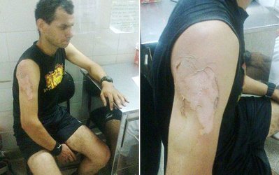 سوژه روز | بانوی ناراضی داور فوتبال را سوزاند!