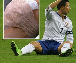 رونالدو دوباره مصدوم شد