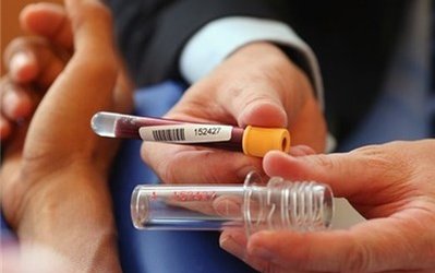 ستاد ملی مبارزه با دوپینگ: در تمامی بازیهای لیگ برتر احتمال نمونه‌گیری وجود دارد