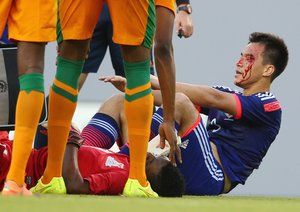 شينجي اوكازاكي|مصدومیت اوکازاکی در دیدار مقابل زامبیا.