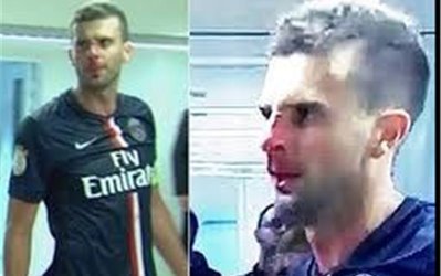 محرومیت دو ساله در انتظار ضارب موتا