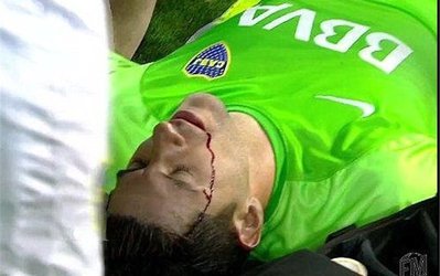 تصاویر روز | هواداران روساریو سر دروازه‌بان بوکاجونیور را شکستند