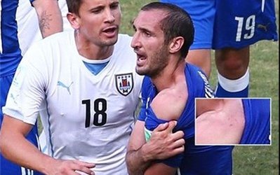 گزارش تصویری از گاز گرفتن سوارز!