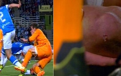 زانوی سوراخ‌شده گران‌‌ترین بازیکن فوتبال جهان